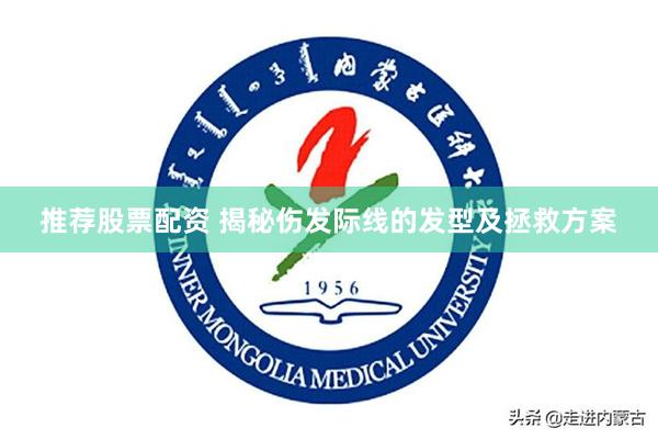 推荐股票配资 揭秘伤发际线的发型及拯救方案